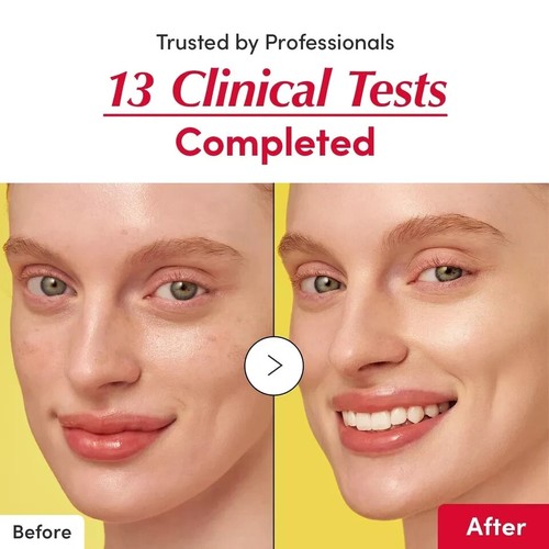 Vitamin Illuminating Serum - Aufhellendes Vitamin C Serum mit Acerola und N - Bild 5 von 6