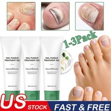 1~3PCS Nutraboost Nail Fungus Treatment Gel, Nail Fungus, Fungus Cream 2025 NEW