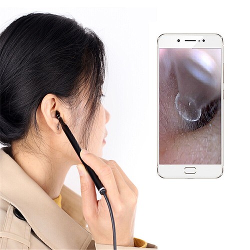LED Endoscope Otoscope Ear Camera Scope Ear Wax Removal Kit Earwax Cleaning - Picture 4 of 11
