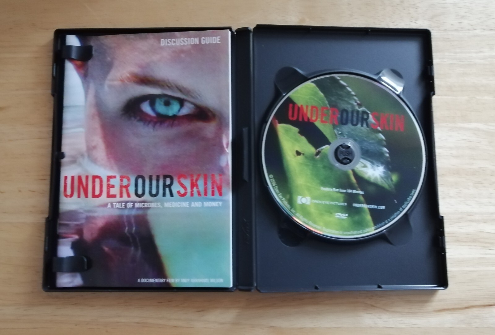 Under Our Skin Lyme Disease Documentary DVD Rare Region Free DVD UK