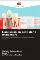 Nikhath Sultana Nasir (U. A.) | L'occlusion En Dentisterie Implantaire | Buch