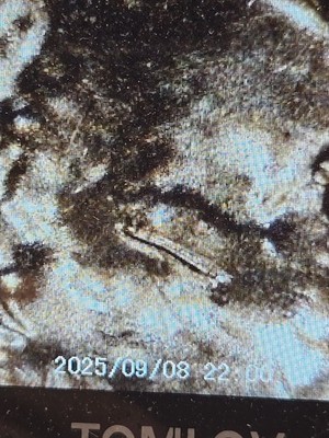 2025 D Lincoln Shield Cent Penny with A Die Clash On Forehead Mint