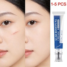 1-5X SCAR REMOVAL CREAM Skin Repair Scar Remover Fade Stretch-MarkAcne Treatment