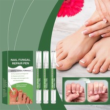 Anti Fungal Treatment Extra Strength Toenail Fungus Foot Nail Repair Pen -20 OFF