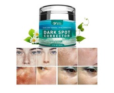 Crema Removedor De Las Manchas Oscuras En La Cara Piel Protecci n Solar