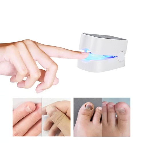 Dispositivo digital para el cuidado con láser de hongos en las uñas - Lámpara de reparación y limpieza de onicomicosis - Imagen 4 de 12