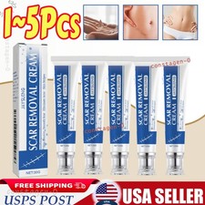 1 5PCS Scar Removal Cream Skin Repair Acne Treatment Fade Stretch Markers Burns