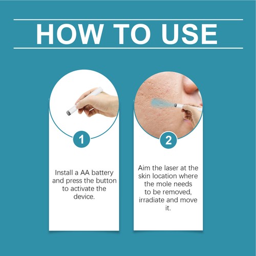 Non-Invasive Mole And Wart Removal Laser Pen, Advanced Skin Tag Removal Pen - Picture 9 of 12