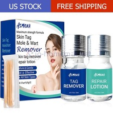 Skin Tag Remover and Repair Liquid Mole Corrector Wart Skintag Foot Corn removal