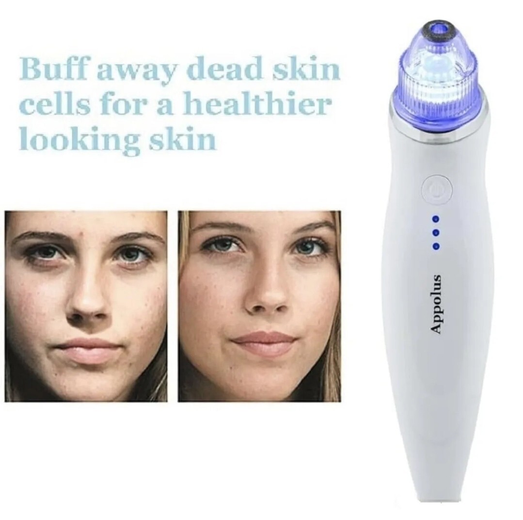 APPOLUS Professional Microderm Device. Diamond Microdermabrasion Facial