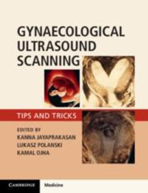 Thumbnail - Gynaecological Ultrasound Scanning | Tips And Tricks | Jayaprakasan