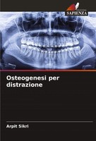 Osteogenesi Per Distrazione Arpit Sikri Taschenbuch Italienisch 2024