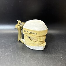 Full Mouth Teeth Mold Metal Jaw Dentures Impressions Oddity Macabre Halloween/ 1