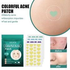 EELHOE Love Acne Patch Gentle Cleansing Acne Patch Fades Facial Acne Marks And S