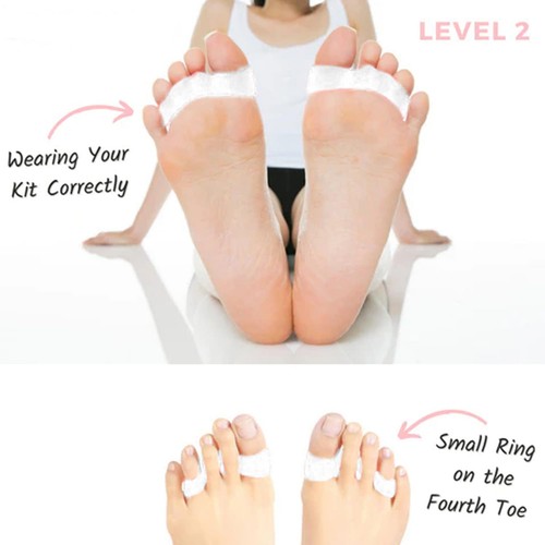 Bodyfeet Aligners Kit Orthopedic Bunion Gel Leg Type Toe Ring Toe - Afbeelding 4 van 12