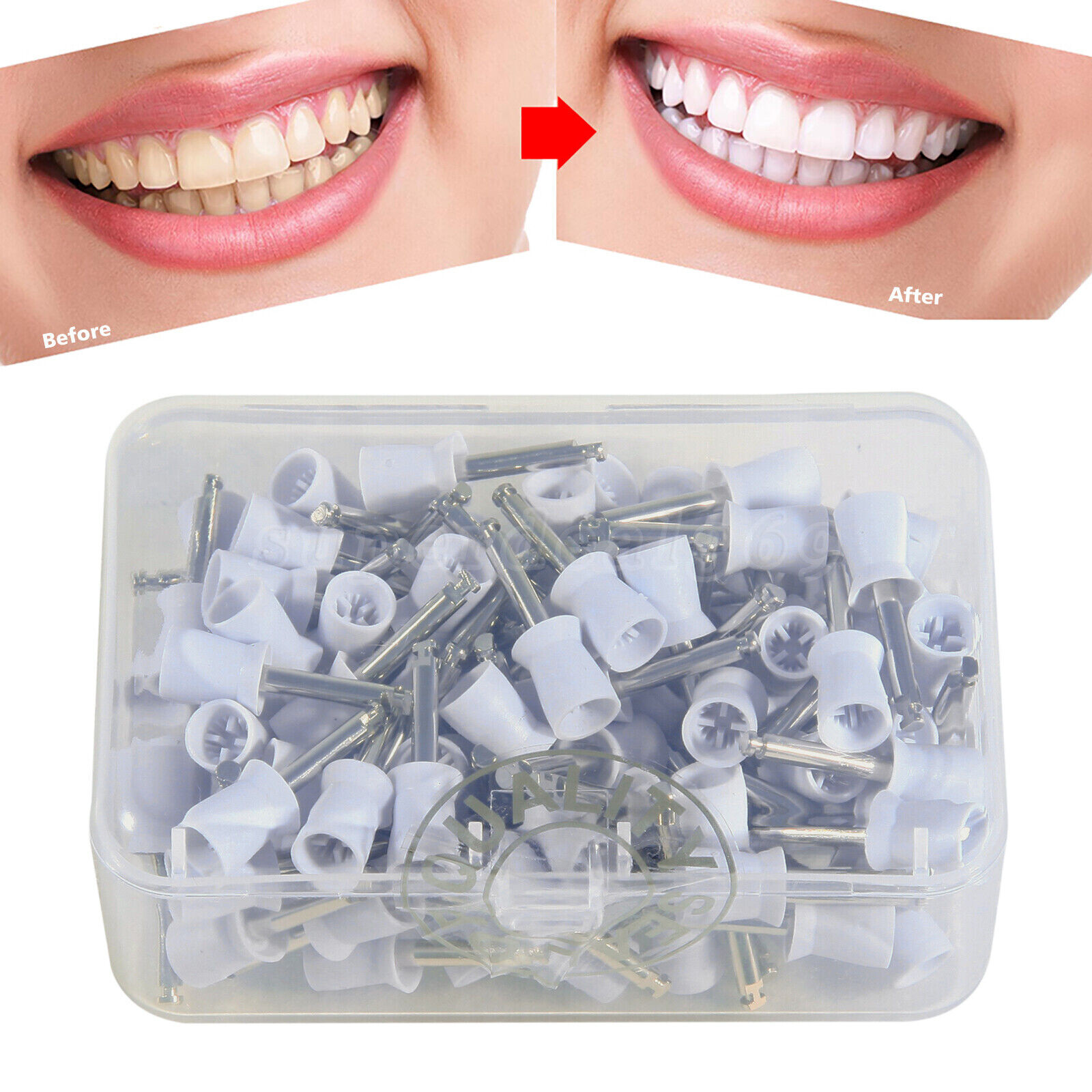 100-1000pc Dental Tooth Prophy Polishing Cups Polish brushes Blue/White/Green kv