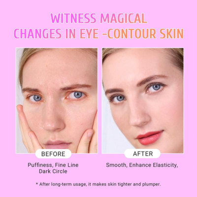 Under Eye Patches (30 Pairs) Gold Eye Mask and Hyaluronic Acid Eye Patches fo...