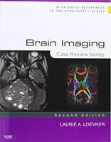 Brain Imaging: Case Review Series, 2e By Laurie A. Loevner Md, (paperback), Mosb on sale Brain Imaging: Case Review Series, 2e By Laurie A. Loevner Md, (paperback), Mosb on sale