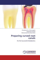 Chanderan A. L. Shanmugam (U. A.) | Preparing Curved Root Canals | Taschenbuch