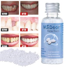 Temporary Tooth Repair Kit Beads Fix Broken False Teeth Fill Gaps Dental Denture