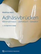 Matthias Kern Adhäsivbrücken