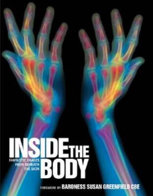 Inside the Body: Fantastic Images from Beneath the Skin - Paperback - GOOD