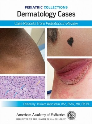 Pediatric Collections Dermatology Cases Case by American Academ PAPERBACK