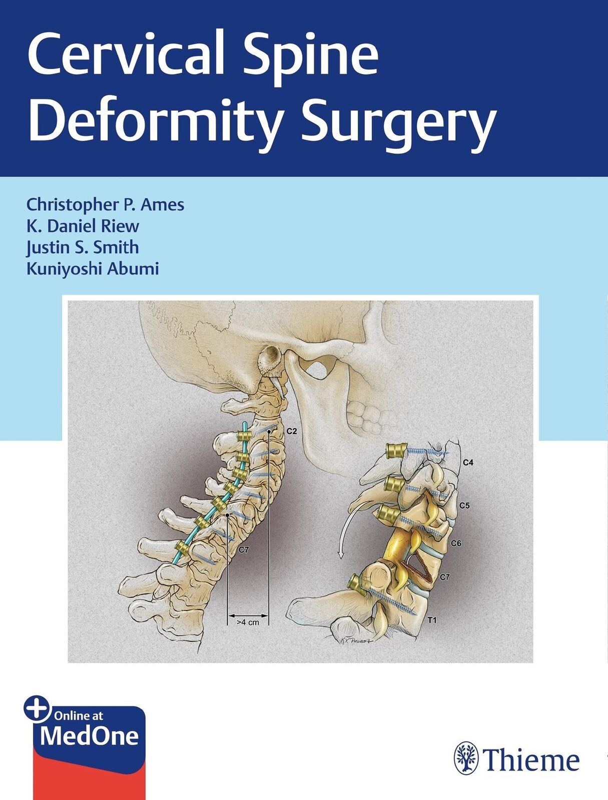 Thumbnail - Cervical Spine Deformity Surgery | Christopher P Ames (u. A.) | Buch |