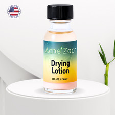 Acne Zap Drying Lotion 1oz Overnight Acne Spot Treatment
