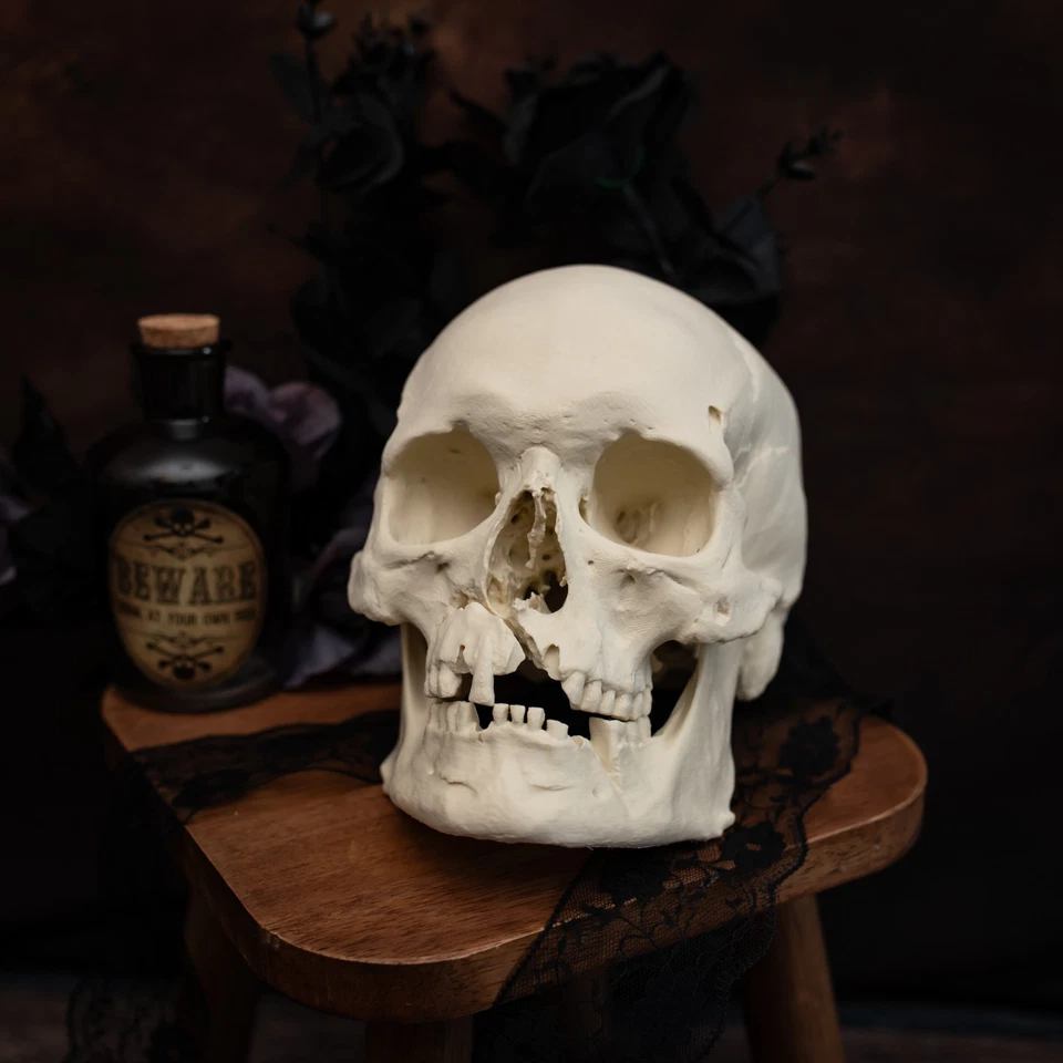 Réplica de cráneo humano de tamaño natural | Herida de hacha de guerrero medieval | Modelo anatómico - Imagen 3 de 4