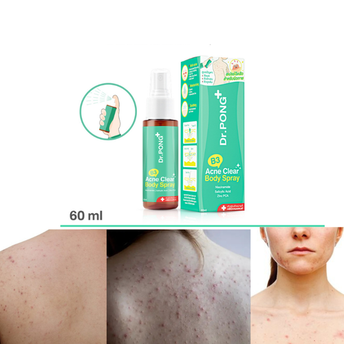 Body Acne Back Arm Leg Breast Reduce Dark Spot Clear Pimple Fast Result