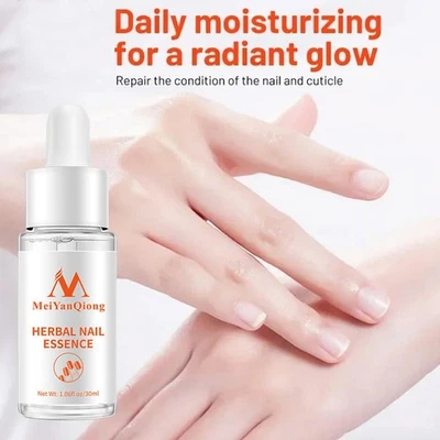 MARKENLOS 30ml Herbal Toenail Repair Essence Effective Nail Serum For Women