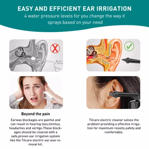 Electric Ear Wax Removal Tool Water Powered Wush Ear Cleaner Ear Cleaning - Picture 5 of 13