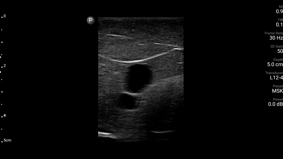 Internal Juglar ultrasound phantom -CVC (FLUID FREE) - Image 4 of 4