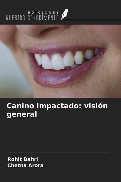 Rohit Bahri (U. A.) | Canino Impactado: VisióN General | Taschenbuch | Spanisch-image