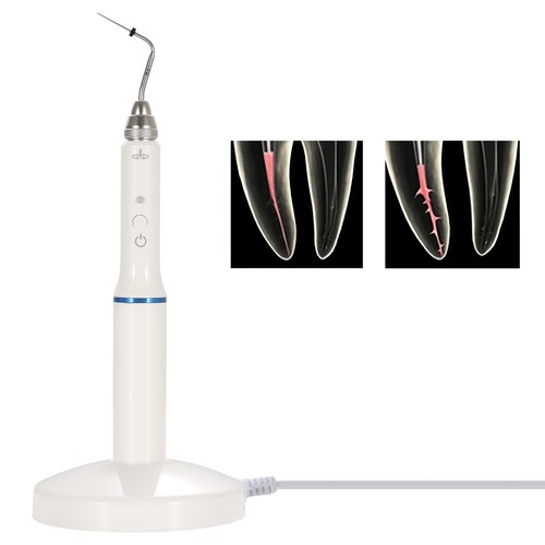 Dental Endodontic Gutta Percha Obturation Pen / Dental Endo Heated Tips - Picture 7 of 40