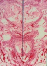 Blush Inlace Acrylester 103 2 pc Knife Scales 3/8"x2"x6"  001
