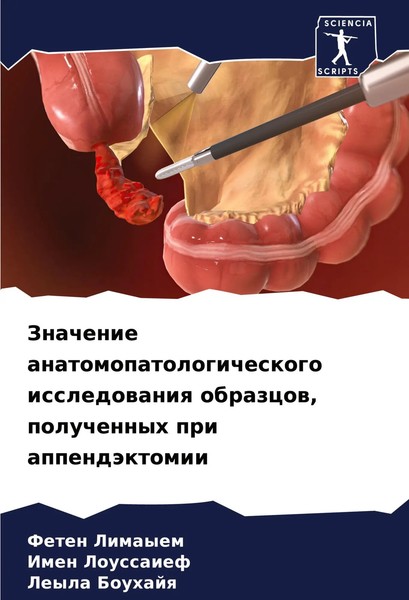 Feten Limayem (U. A.) | Znachenie Anatomopatologicheskogo Issledowaniq...-image