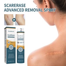 Scar Removal Gel, Healing Skin Repair Gel for Scars, Burns, Stretch Marks