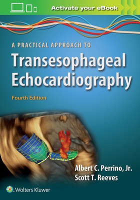 Albert C. Perrino A Practical Approach to Transesophageal Echocardiography