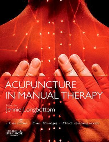 Acupuncture in Manual Therapy Longbottom Paperback Churchill Livingstone