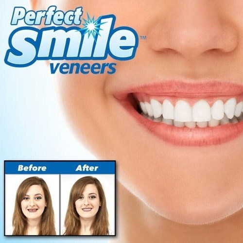 PROTESI DENTALE PERFECT SMILE DENTIERA DENTI PERFETTI RIUTILIZZABILE - Foto 5 di 7