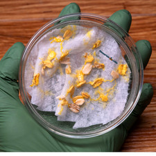 Physarum Polycephalum Sclerotium Slime Mold B...