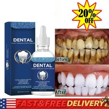60ml Tooth care solution Dentite Cavity Healing Tooth Armor NEW HOT