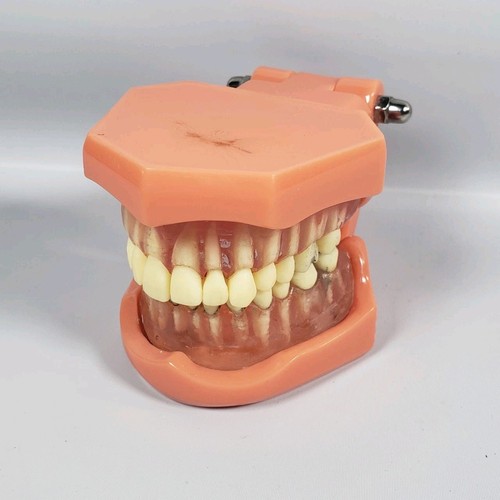 Vintage Training Dental Teeth Model with Removable Teeth (Incomplete)