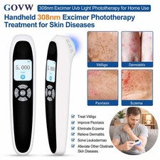 Portable 308nm UVB Light Therapy Device Rechargeable Excimer Phototherapy Tool