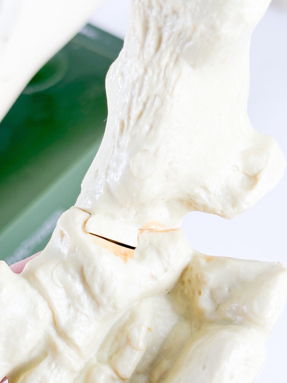 Merck Sharpe & Dome Anatomic Foot Model