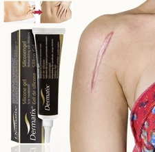 Dermatix 60g Scar Treatment Gel