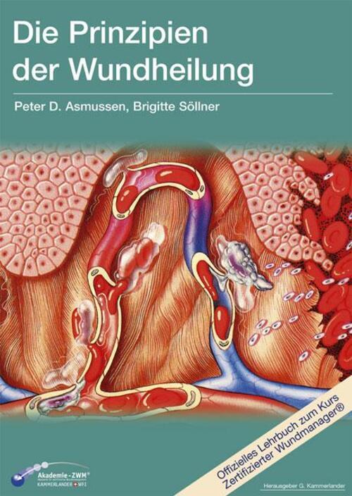 Thumbnail - Die Prinzipien Der Wundheilung | Wundtypen, Wundheilungsvorgänge Und