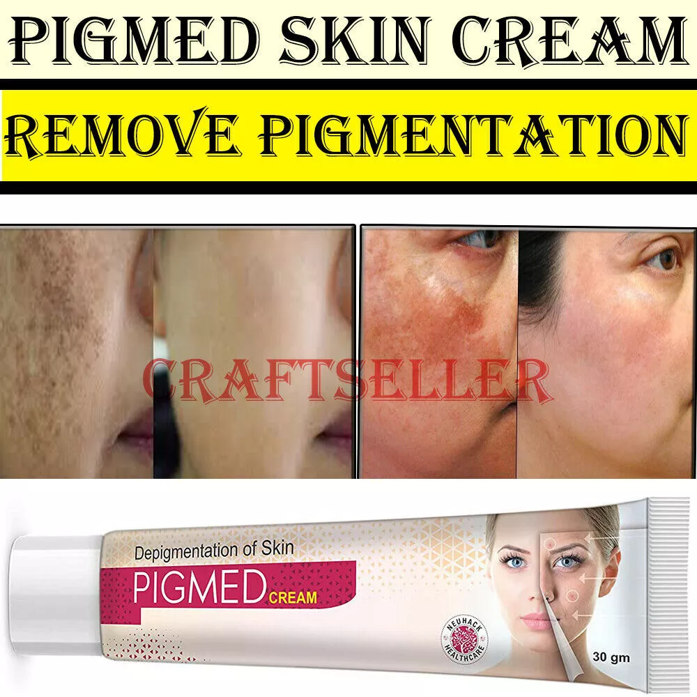 Pimple marks cream deals
